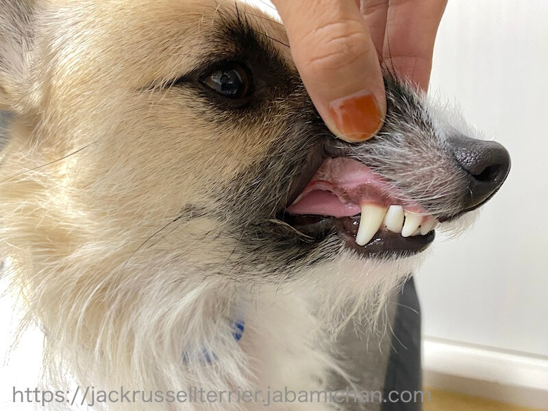犬 歯の磨耗